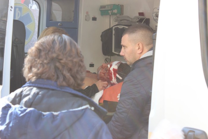 ЗМІ оприлюднили фото постраждалого під час нападу на Кобилянської
