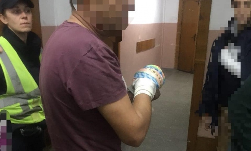 На Буковині чоловік з власної необережності травмував руку циркулярною пилою