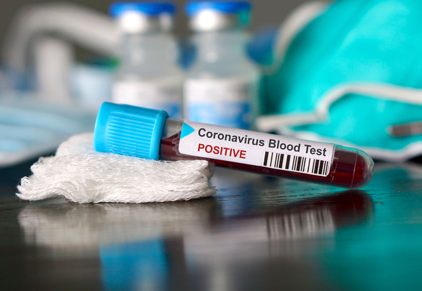 На Буковині виявили понад 1080 випадків коронавірусу