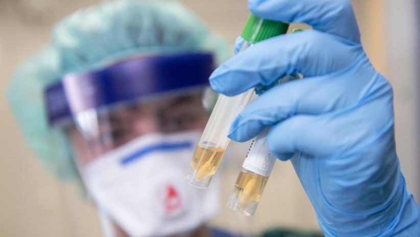 На Буковині виявили понад 310 випадків коронавірусу