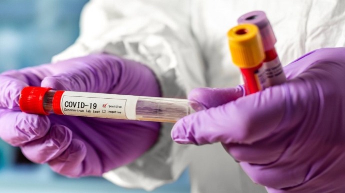 На Буковині виявили понад 110 випадків коронавірусу