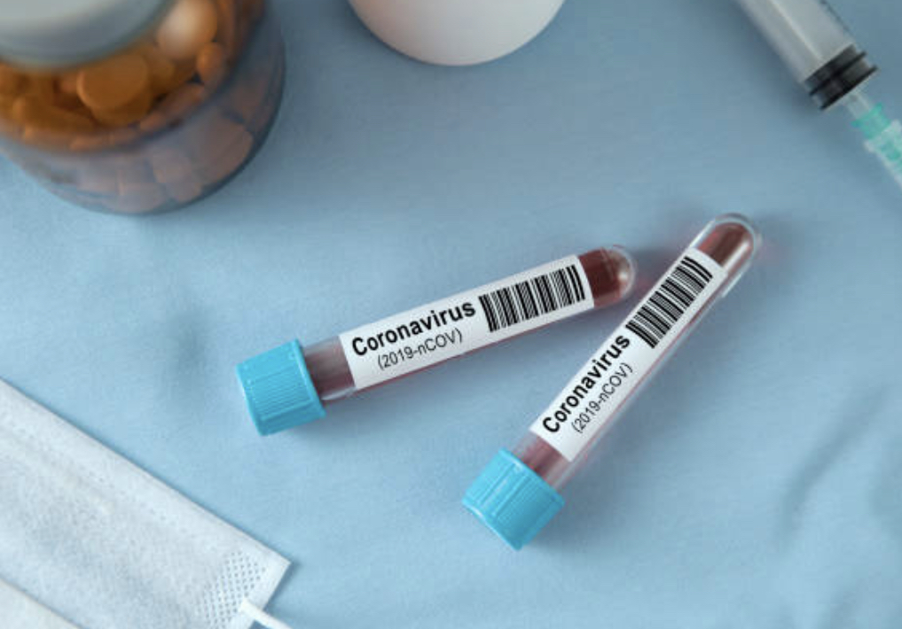 Захворюваність зростає: за добу зафіксували понад 30 тисяч випадків коронавірусу