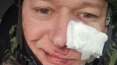 Андрій Хливнюк потрапив під мінометний обстріл: артиста поранено в обличчя